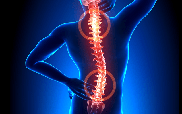 Illustration of spinal stress and back pain