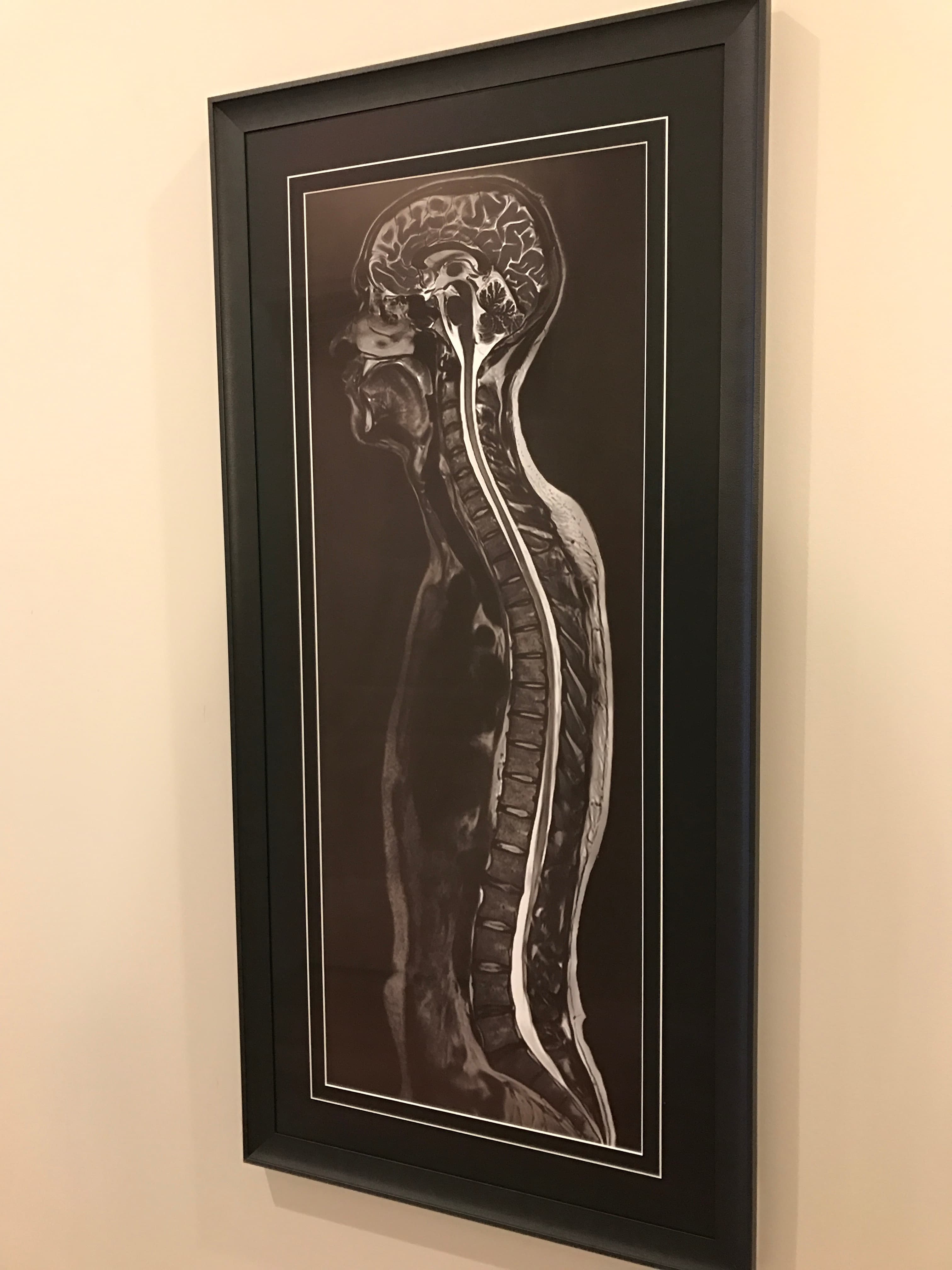 Imaging area